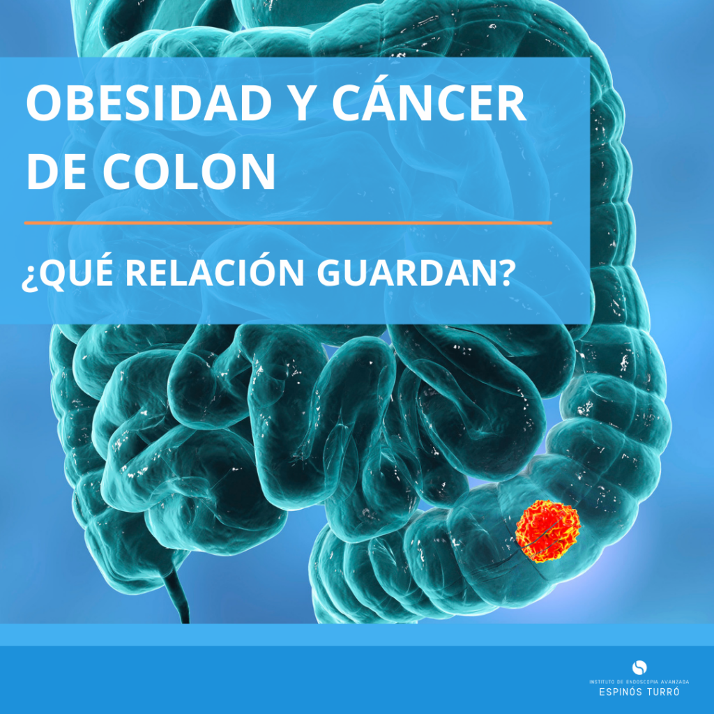 relación entre la obesidad y el cáncer de colon por Instituto de endoscopia avanzada Espinós Turró Dr. Román Turró