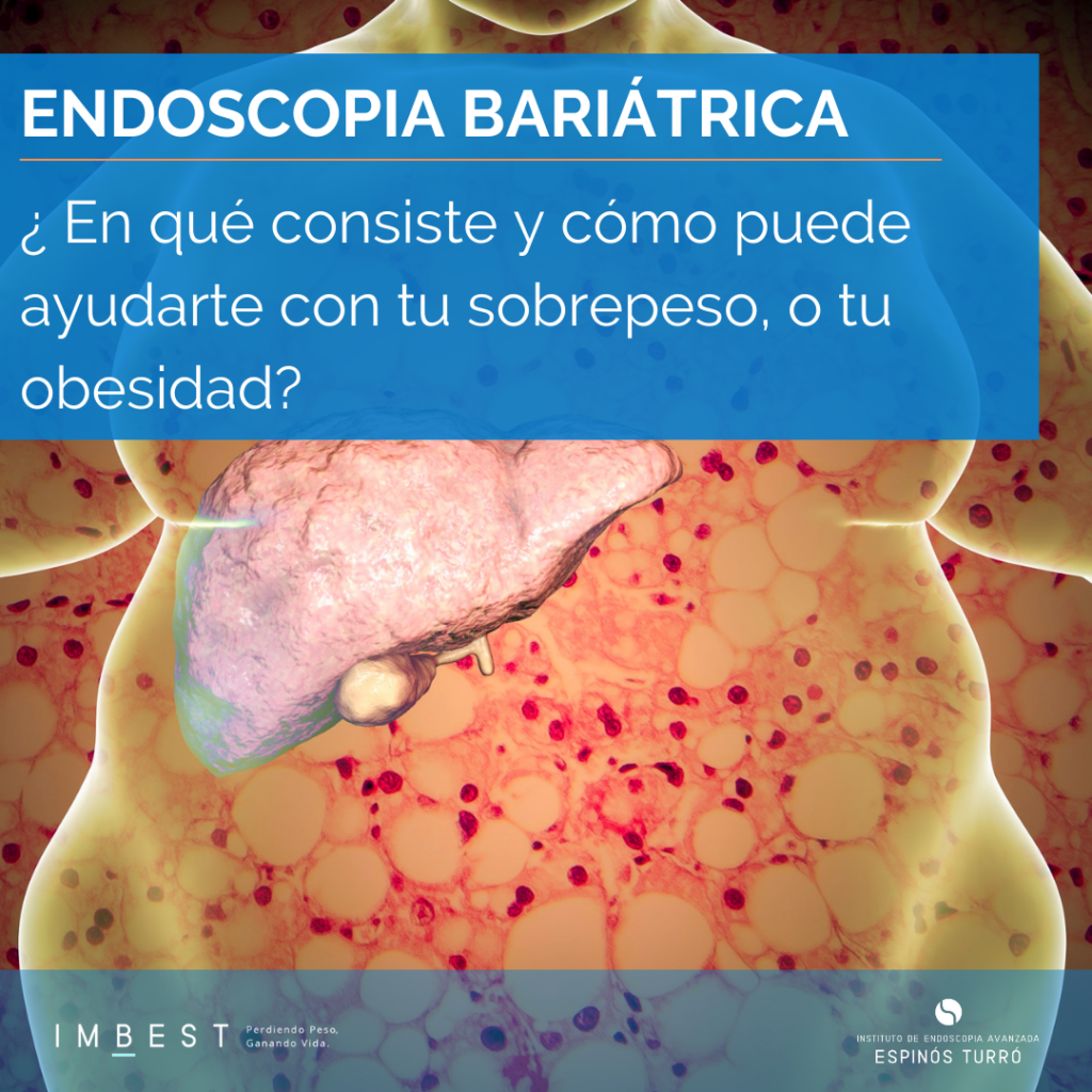 qué es la endoscopia bariátrica sobrepeso y obesidad IMBEST Unidad de pérdida de peso del Centro Médico Teknon de Barcelona